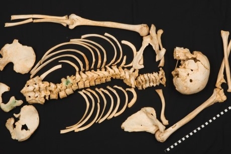 Skeletons%3A Our Buried Bones